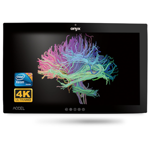 Onyx ACCEL-A3201 i7 32" 4K OR Station PCAP Touch – Medical IT | ACP Online
