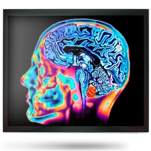 Onyx MEDDP-415HNN 15" Medical Display – Medical IT | ACP Online
