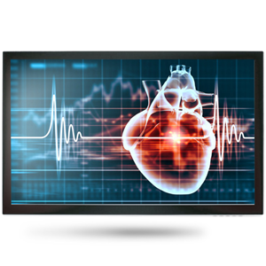 Onyx MEDDP-615HPN 15.6" Medical Touch Display – Medical IT | ACP Online