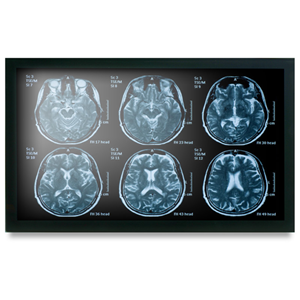 Onyx MEDDP-622HNN 21.5" Medical Display – Medical IT | ACP Online