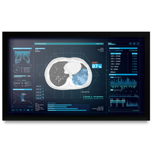 Onyx MEDDP-627HPN 27" Medical Touch Display – Medical IT | ACP Online