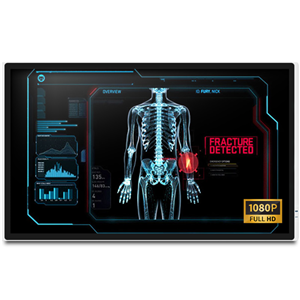 Onyx MEDDP-632F-P1 32" FHD Medical Touch Display – Medical IT | ACP Online