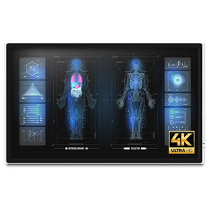 Onyx MEDDP-632-P1 32" 4K Medical Touch Display – Medical IT | ACP Online